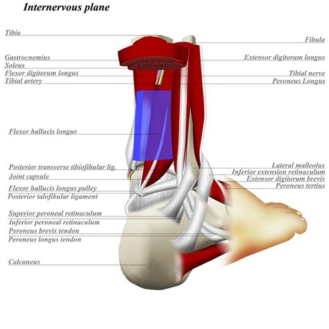 Ankle Posterolateral Approach - Approaches - Orthobullets