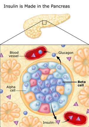 General Surgery - Type 2 Diabetes