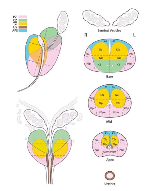 BLADDER CORONAL SECTION