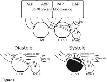 A Mock Circulatory System to Research the HeartWare Pump Flow Waveform - The Journal of Heart ...