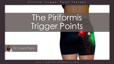 The Piriformis Trigger Points - YouTube