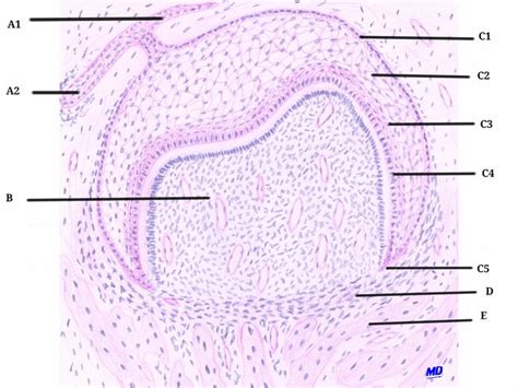 Early Bell Stage: Early Bell Stage A1- Remaining Dental Lamina A2- Secondary/Permanent Tooth Bud ...