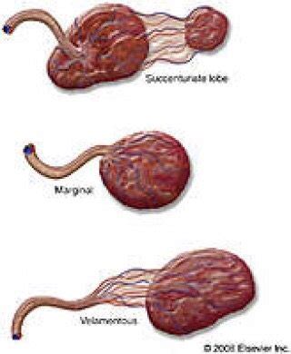 Morphology scan today | BabyCenter