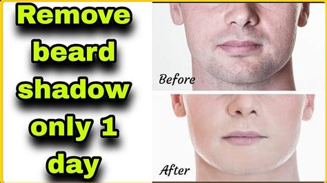 how to remove beard shadow ! - YouTube