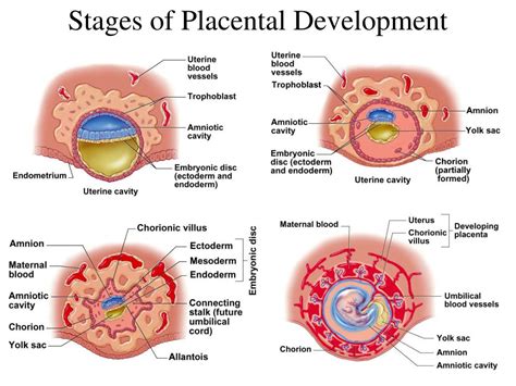 Convalescent stage of pertussis: Pertussis: Clinical Features | CDC