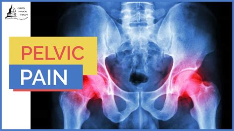 How Physical Therapy Can Help Treat Pelvic Pain | Capitol Physical Therapy | Pelvic Pain in ...