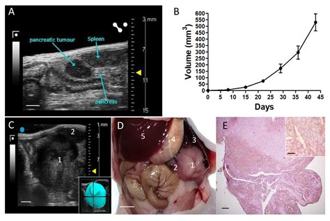 Generation of an Orthotopic Xenograft of Pancreatic Cancer Cells by Ultrasound-Guided Injection ...