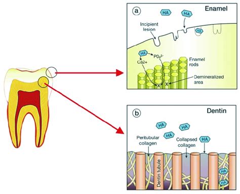 The mechanism of action of HA on the remineralisation of enamel (a) and ...