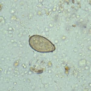 CDC - DPDx - Clonorchiasis - Images