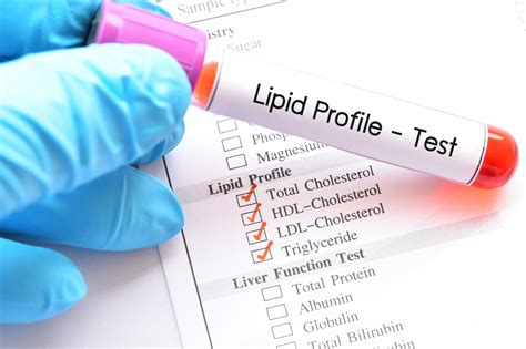 Elevated Lipoprotein(A) in Children and Adolescents: Early Identification is Key for Successful ...