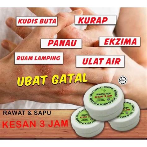 Krim Daun Gelenggang Ubat Gatal, Kurap, Panau, Sakit Kulit Krim Eczema ...