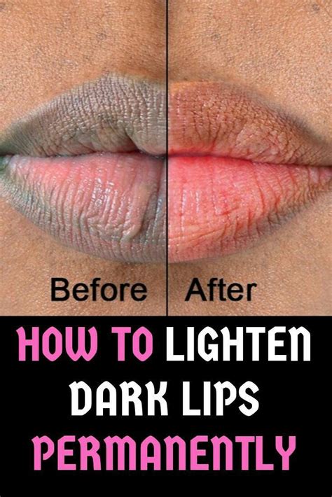 Pin by elifefoods on Daily health | Natural pink lips, Remedies for ...