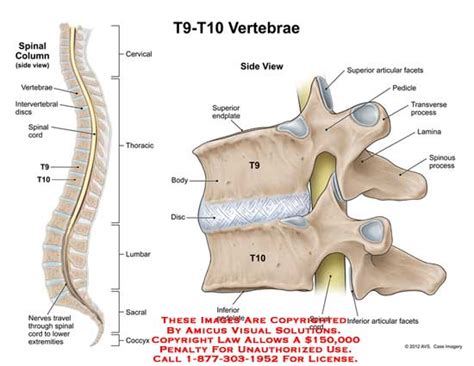 vertebrae – Anatomy Exhibits