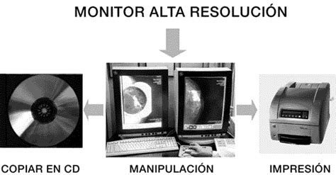 MAMOGRAFIA "FULL DIGITAL" DIRECTA O EN CAMPO COMPLETO: EXPERIENCIA PRELIMINAR