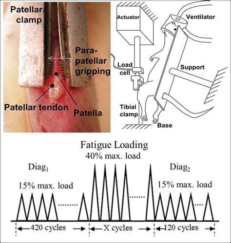 What is the Pathogenesis of Tendon Degeneration? – Andarawis-Puri Research Group