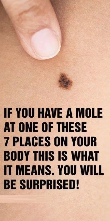 IF YOU HAVE A MOLE AT ONE OF THESE 7 PLACES ON YOUR BODY THIS IS WHAT IT MEANS - in 2020 | Mole ...