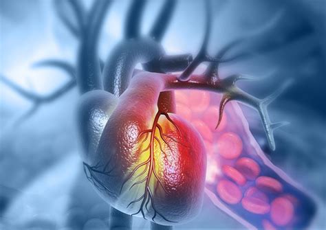 Coarctation of the Aorta Surgery