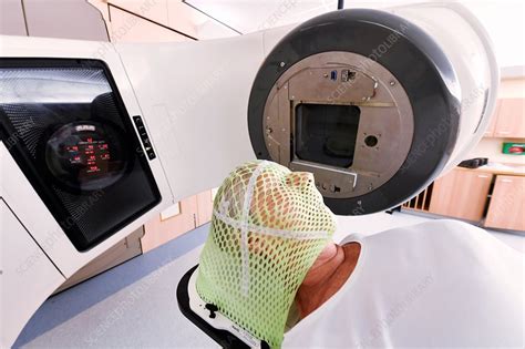 Brain cancer radiotherapy - Stock Image - C033/9853 - Science Photo Library