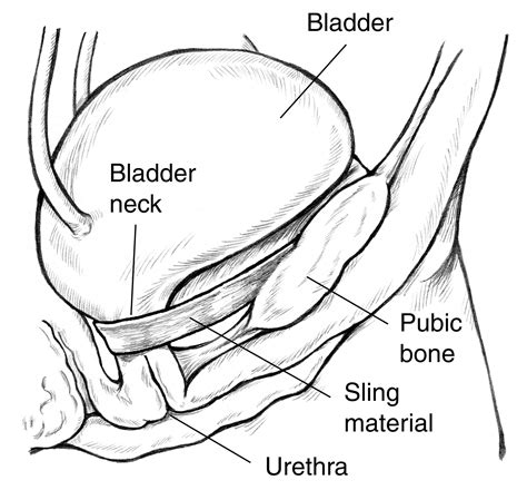 Pin on Urinary System