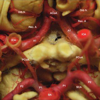 Supraclinoid segment of the internal carotid artery. Figure 1. Circle... | Download Scientific ...