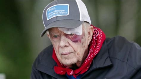 Former President Jimmy Carter recovers from brain surgery