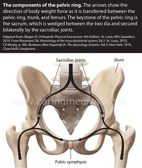 Pubic symphysis injury in Male Athletes does this ever heal?