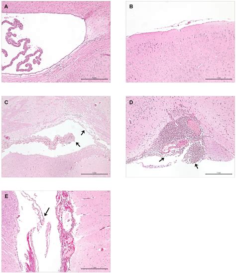 Pathogens | Special Issue : Streptococcus suis