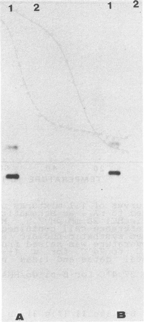 Northern blot analysis with 5' end labeled a-or Boligonucleotidic... | Download Scientific Diagram