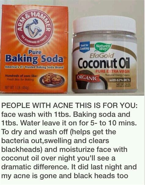 Home remedy for acne | Diy acne treatment, Homemade acne treatment, Natural acne