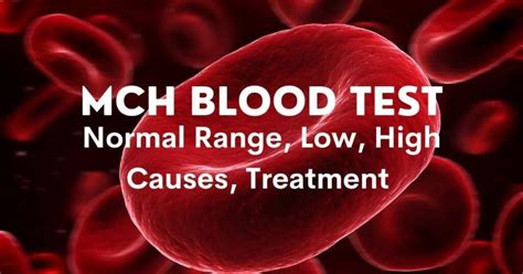 MCH Blood Test: High, Low, Symptoms, Treatments, Complete Details ...