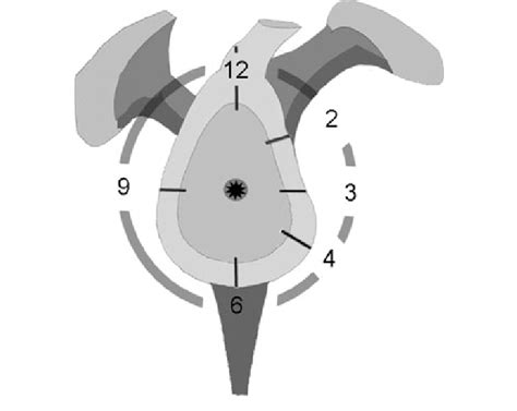 A schematic drawing of the labrum positions investigated in this study ...