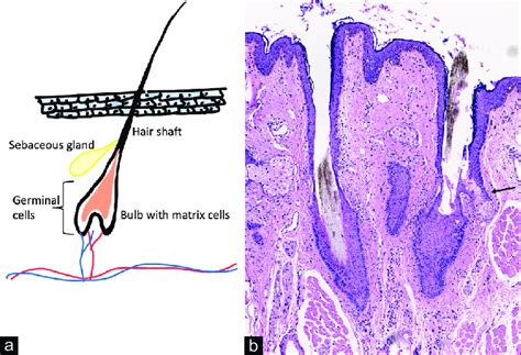 Schematic representation of a pilosebaceous unit of the eyelash.... | Download Scientific Diagram