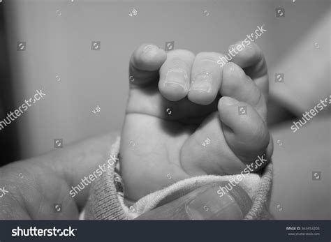 Polydactyly Child Hand Congenital Six Fingers Stock Photo 363453203 ...