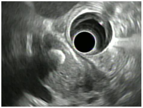 JPM | Free Full-Text | Clinical Management of Bile Duct Diseases: Role ...