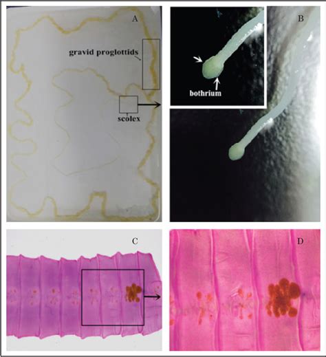 Figure 1 from A case of Diphyllobothrium latum infection in Dalian and ...