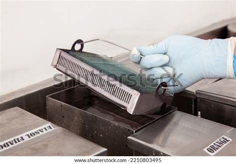 Scientist Staining Microscope Slides Cytology Studies Stock Photo 2210803495 | Shutterstock