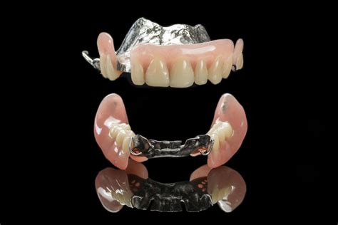 Edentulism: Finding the Perfect Fit with Partial Dentures