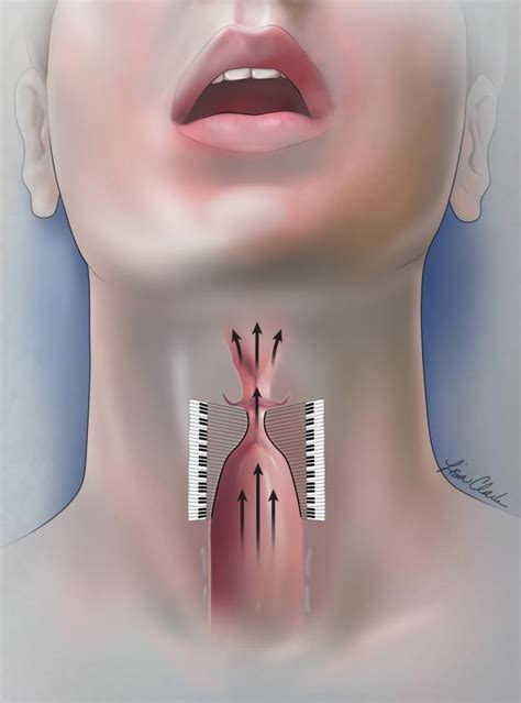 Pitch range produced by vocal cords | EurekAlert!