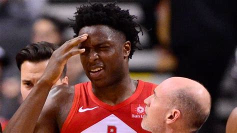 Toronto Raptors forward OG Anunoby undergoes emergency appendectomy | CBC Sports