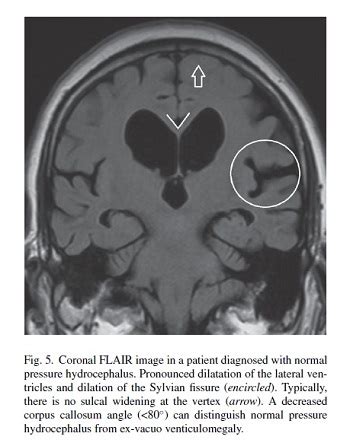 Clinical Application of Brain MRI in the Diagnostic Work-up of ...