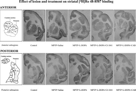 Examples of autoradiography of the binding of [ 3 H]Ro 48-8587 to AMPA... | Download Scientific ...