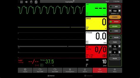 Pulseless Ventricular Tachycardia with Defibrillation - YouTube