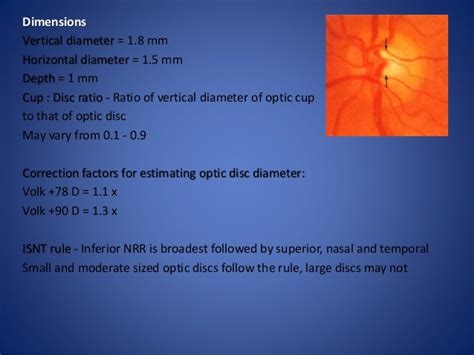 Optic disc evaluation