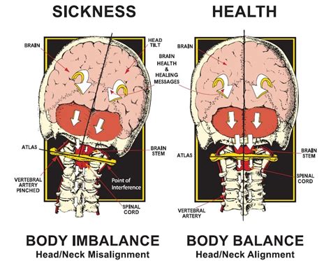 Chiropractic Care - About Atlas Orthogonal