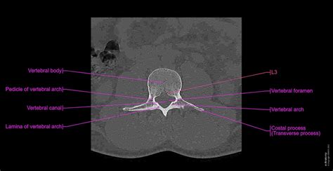 lumbar spine: normal anatomy | e-Anatomy