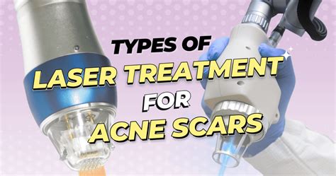 Types of Laser Treatment for Acne Scars | Skin Clinic Johor Bahru ...