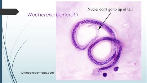 Wuchereria bancrofti: Morphology, life cycle and Epidemiology - Online Biology Notes