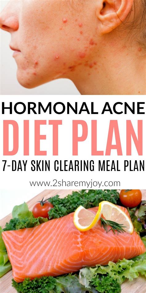 Hormonal Acne Diet Plan {best 7-day clear skin meal plan PDF} | Acne ...