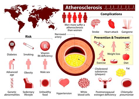 Get to know the difference between Atherosclerosis and Arteriosclerosis.