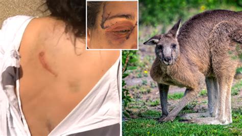 Victorian woman needed 25 stitches in face after kangaroo attack | 7NEWS